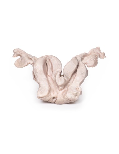 Unicollis bicornuate uterus - Erler Zimmer 3D anatomy Series MP2104