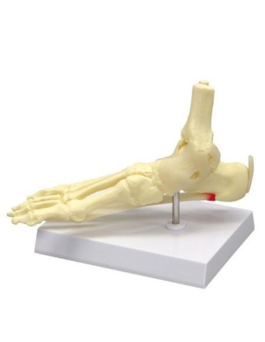 Erler Zimmer, anatomical foot and ankle model - Plantar Fasciitis 6055