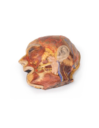 Oberflächliche Gesichtsnerven und Ohrspeicheldrüse - Erler Zimmer 3D-Anatomie Serie MP1109