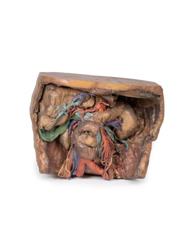 Abdominal vasculature - Erler Zimmer 3D anatomy Series MP1131