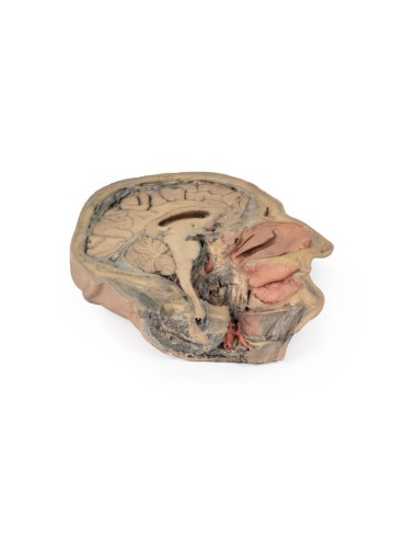 Sagittal section of the head with deep dissection - Erler Zimmer 3D anatomy Series MP1105