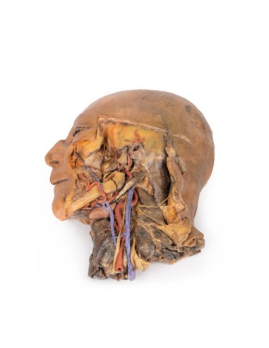 Sagittalschnitt von Kopf und Hals mit Fossa intratemporalis und Carotisscheide - Erler Zimmer 3D-Anatomie Serie MP1111