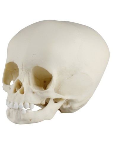 15-month-old baby skull Erler Zimmer 4740