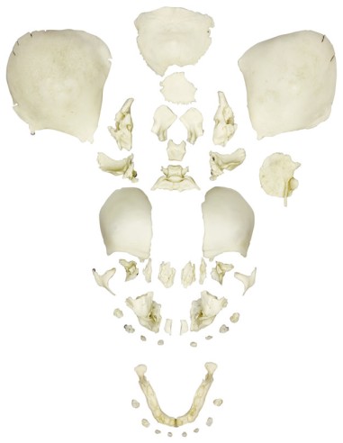 Fully developed disassembled fetal skull Erler Zimmer 4728