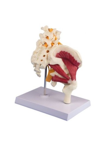 Erler Zimmer, anatomical model of hip joint with muscles and sciatic nerve 4049