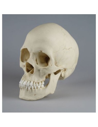 Erler Zimmer, anatomical model of scaphocephalic skull 4778