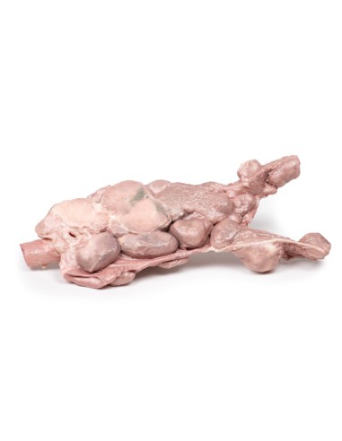 Aortale und para-aortale Lymphknoten - Erler Zimmer 3D-Anatomie Serie MP2103