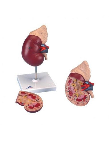 Anatomical model of kidney with adrenal gland, decomposable into 2 parts K12