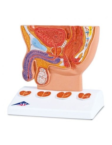 Anatomical model of prostate at half size 3B Scientific K41