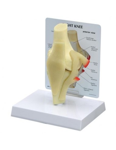 Modelo básico de articulación de rodilla 3B Scientific 1019499