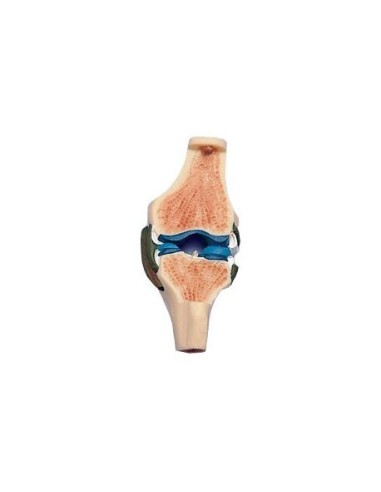 Section of the knee joint W19006