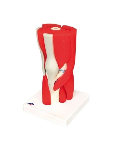 3B Scientific, Knee joint, decomposable into 12 parts A882