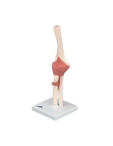 3B scientific, luxury functional model of the elbow joint with ligaments A83/1