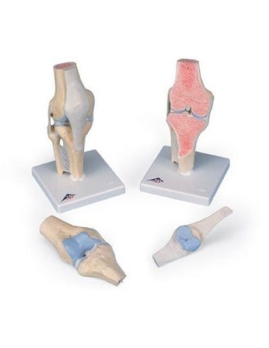 3B Scientific, anatomical model of the knee joint section, in 3 parts A89