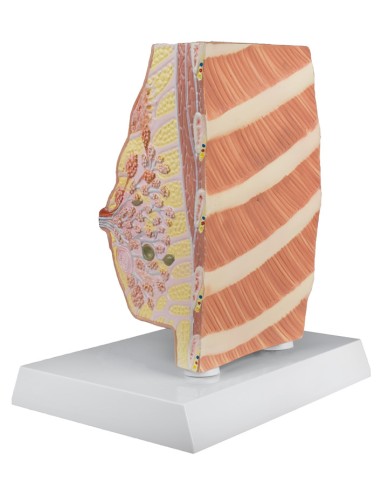 Erler Zimmer, anatomical model of female breast with pathologies L280