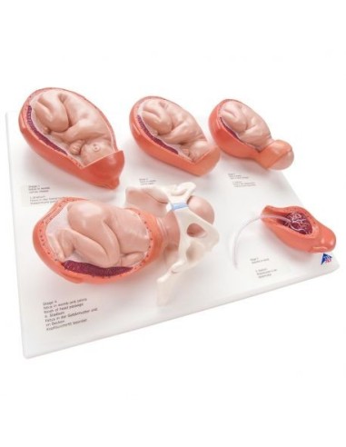 3B Scientific, Anatomical Model of the Stages of Birth, small scale VG393