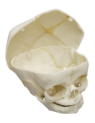 40-week-old fetal skull with removable skull cap Erler Zimmer 4727