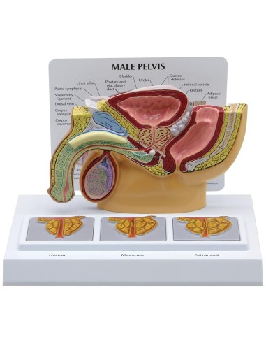 Anatomical model of male pelvis with 3D prostate in section 3B Scientific 1019563