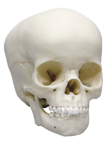 4-year-old child's skull Erler Zimmer 4774