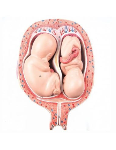 3B Scientific, Embryo Model of Twin Fetuses at 5