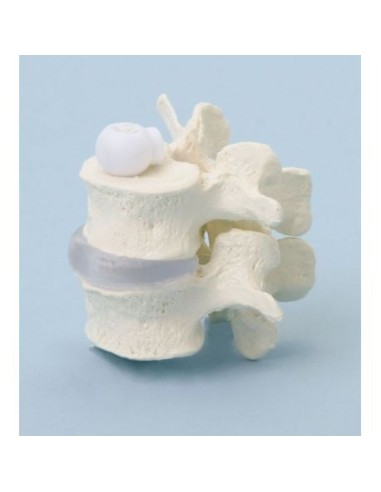 Erler Zimmer, anatomical model of two elastically mounted lumbar vertebrae 4090