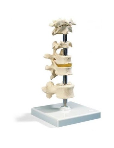 3b Scientific, anatomical model of 6 vertebrae A75