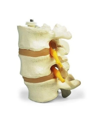 3 lumbar vertebrae, 3B Scientific, elastic mounting A76/8