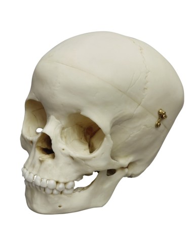 5-year-old child's skull Erler Zimmer 4730