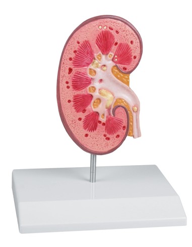 Anatomical teaching model of renal calculus Erler Zimmer K229