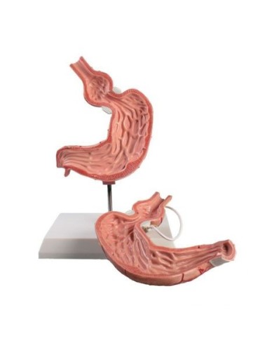 Erler Zimmer, anatomical model of human stomach with gastric banding K82