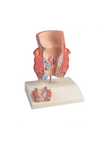 Erler Zimmer, Modello anatomico didattico di emorroidi K227