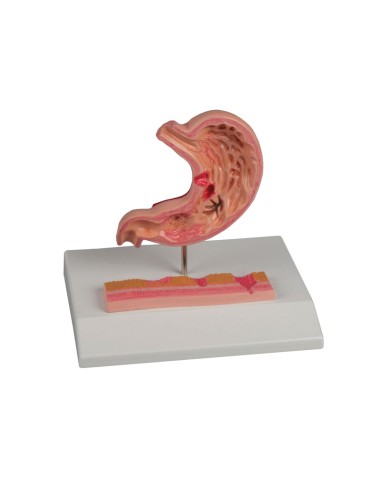 Stomach model with small-sized ulcers, EZ K217