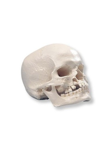 Skull with gnathoschisis and cleft palate, model 3B Scientific A29/3