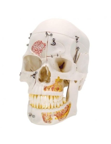 3B Scientific skull, luxury model, for demonstration, in 10 parts A27