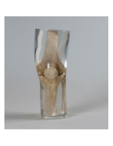 Radiologie-Simulator - Knie - Transparent - Erler Zimmer 7250