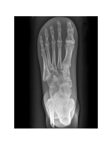 Radiology Simulator - Foot - Transparent - Erler Zimmer 7230