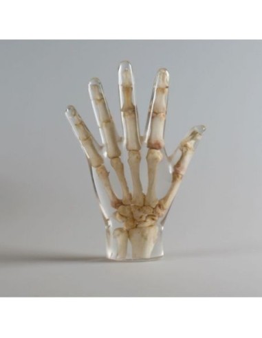 Simulador de Radiología - Mano - Transparente - Erler Zimmer 7210