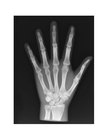 Simulatore per radiologia - Mano - Opaco - Erler Zimmer 7215