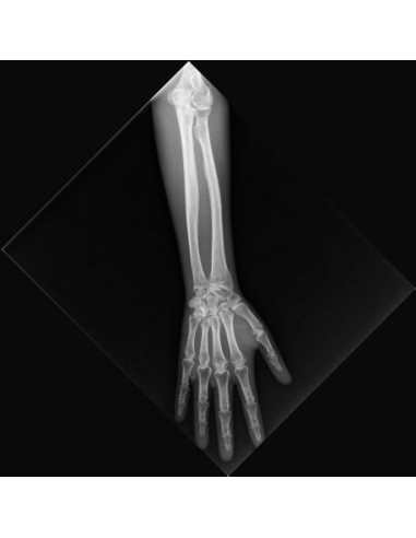 Radiology Simulator - Arm - opaque - Erler Zimmer 7225