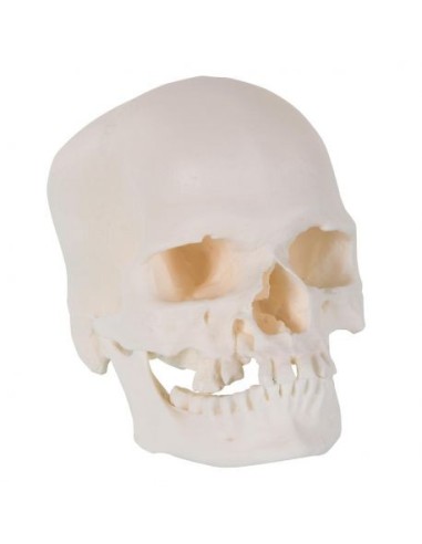 3B Scientific, Microcephalic skull A29/1