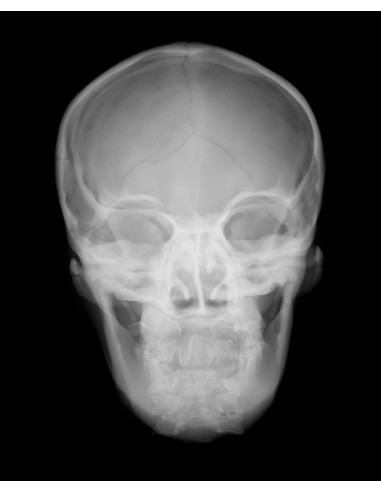 Radiology Simulator - Radiographic skull with artificial bones - Opaque EZ-R16701