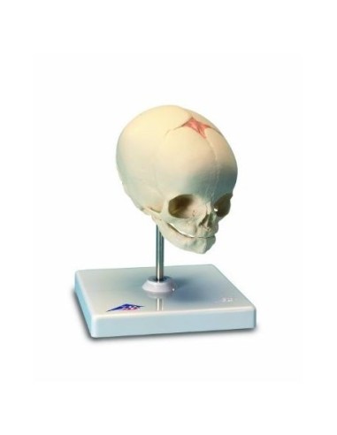 Skull of a fetus, on easel (cod, A26)