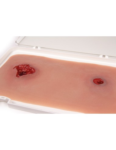 Moulage and simulation of gunshot wound to the leg with bleeding function Erler Zimmer NW105