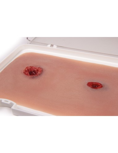 Moulage and simulation of gunshot wound with bleeding function Erler Zimmer NW104