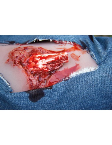 Moulage and simulation of leg wound with exposed fracture and bleeding function Erler Zimmer NW103