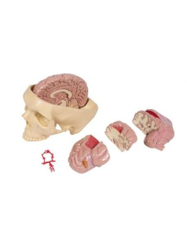 Anatomisches Modell von Hirnerkrankungen, erler zimmer 4525