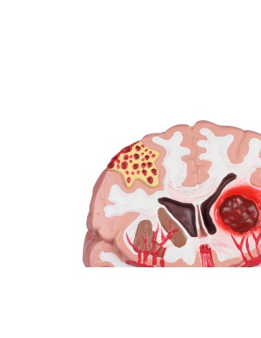 Pathologies du cerveau humain Erler Zimmer C711