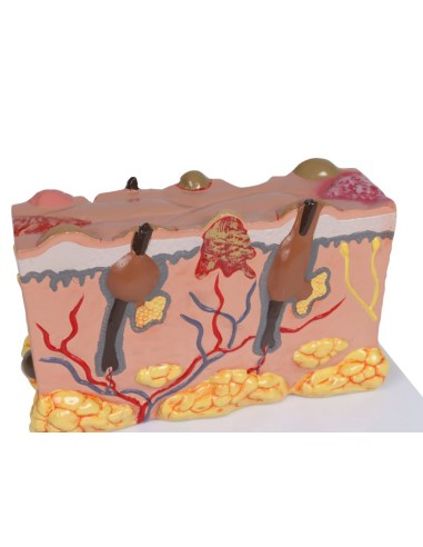 Pathological skin model, magnified 30 times Erler Zimmer EZ-J755