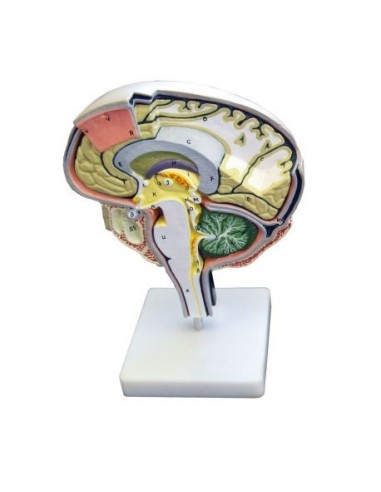 Erler Zimmer, anatomical model of brain section C77