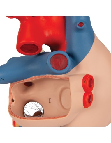 3B Scientific, heart model with bypass, magnified 2 times, decomposable into 4 parts, G06